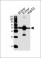 PAH Antibody (Center)